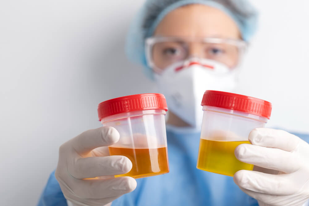 Yassı Epitel Yüksekliği ve Tedavisi