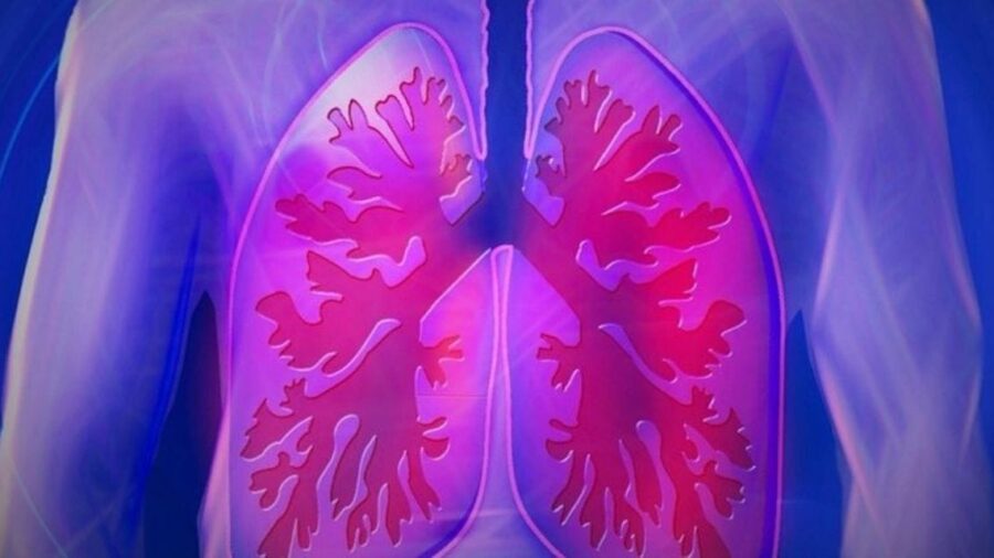 48 saat akciğersiz yaşadı, hayatta kaldı